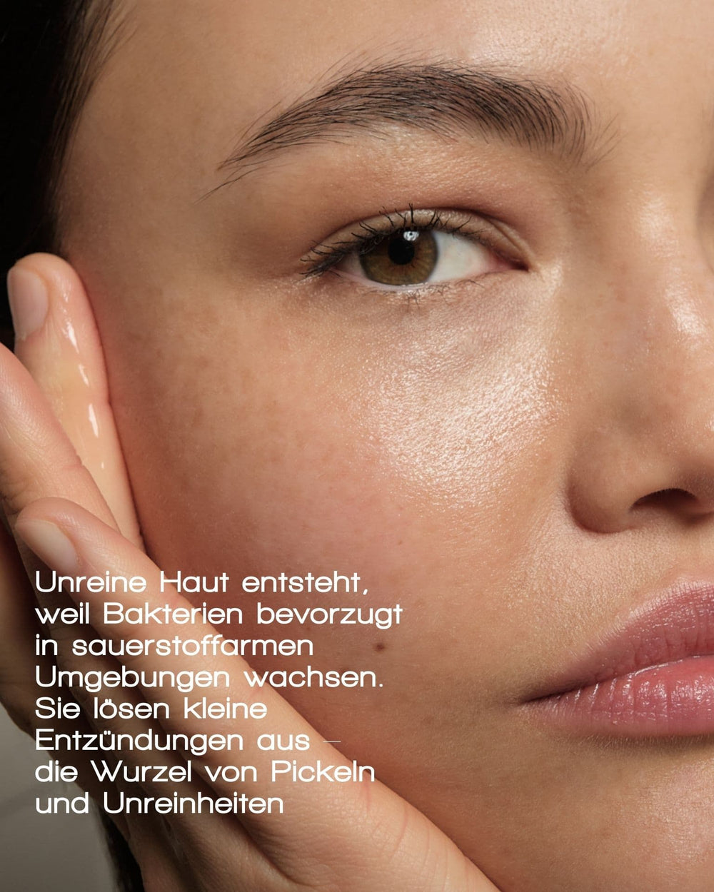 Eine Nahaufnahme einer Frau mit klarer, taufrischer Haut berührt ihre Wange. Der deutsche Text erklärt, wie die OXYGEN WATER PORE CLEARING SOLUTION von MERME Berlin mit Hilfe der Mikrobläschen-Technologie die Poren reinigt und Unreinheiten durch Bakterien in sauerstoffarmer Umgebung verhindert.