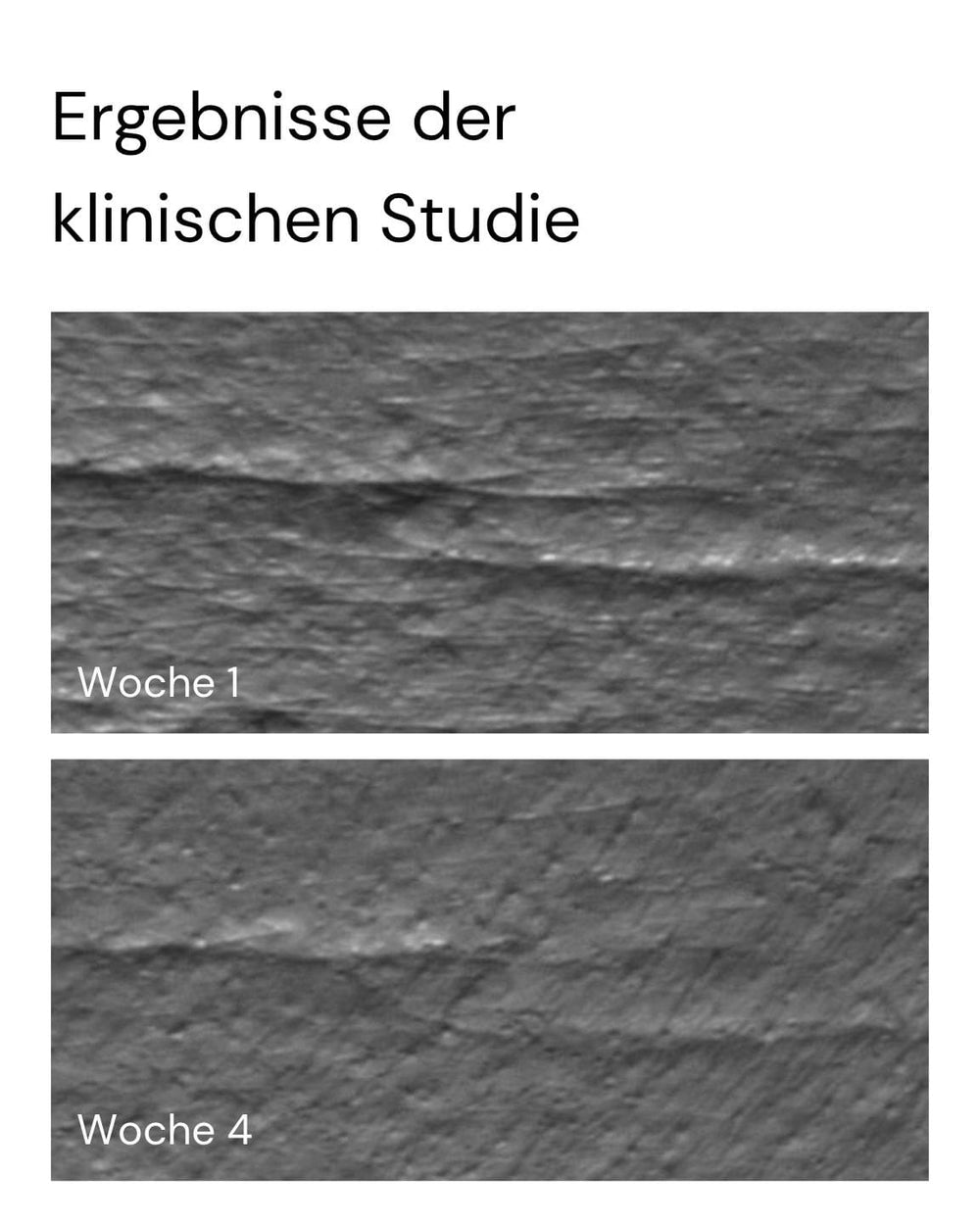 Der Nahvergleich der Gesichtshaut in "Woche 1" und "Woche 4" zeigt, dass die Rötungen nach vierwöchiger Anwendung des New by Morning Retinal Face Serum von MERME Berlin reduziert und die Textur geglättet wurde. Text oben: "Ergebnisse der klinischen Studie.