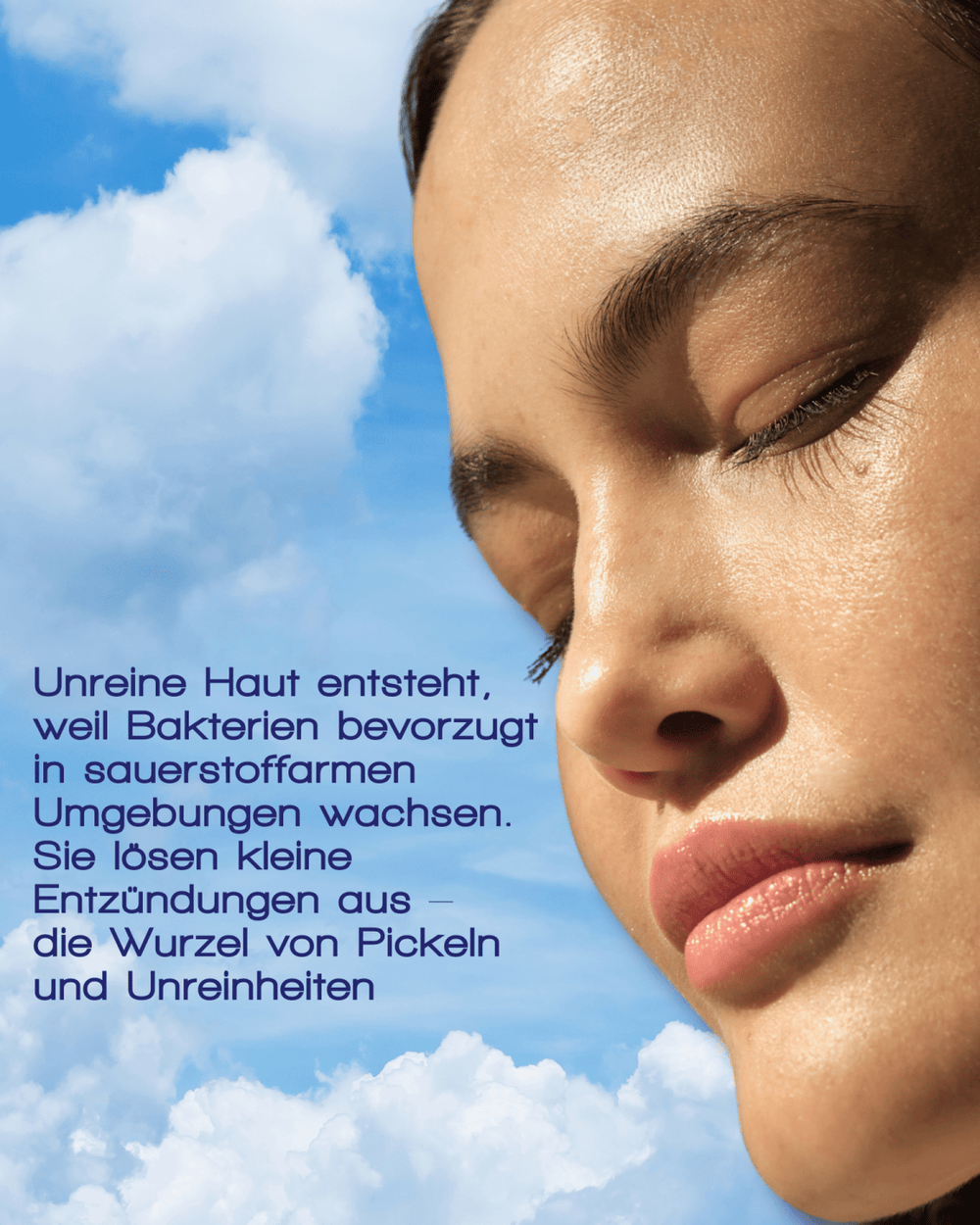 Eine Frau mit klarer Haut steht vor blauem Himmel, während ein deutscher Text beschreibt, wie OXYGEN WATER BY MERME von MERME Berlin mit innovativer Sauerstoff-Microbubble-Technologie hilft, Entzündungen und Hautunreinheiten zu verhindern, die durch sauerstoffarme Bakterien verursacht werden.