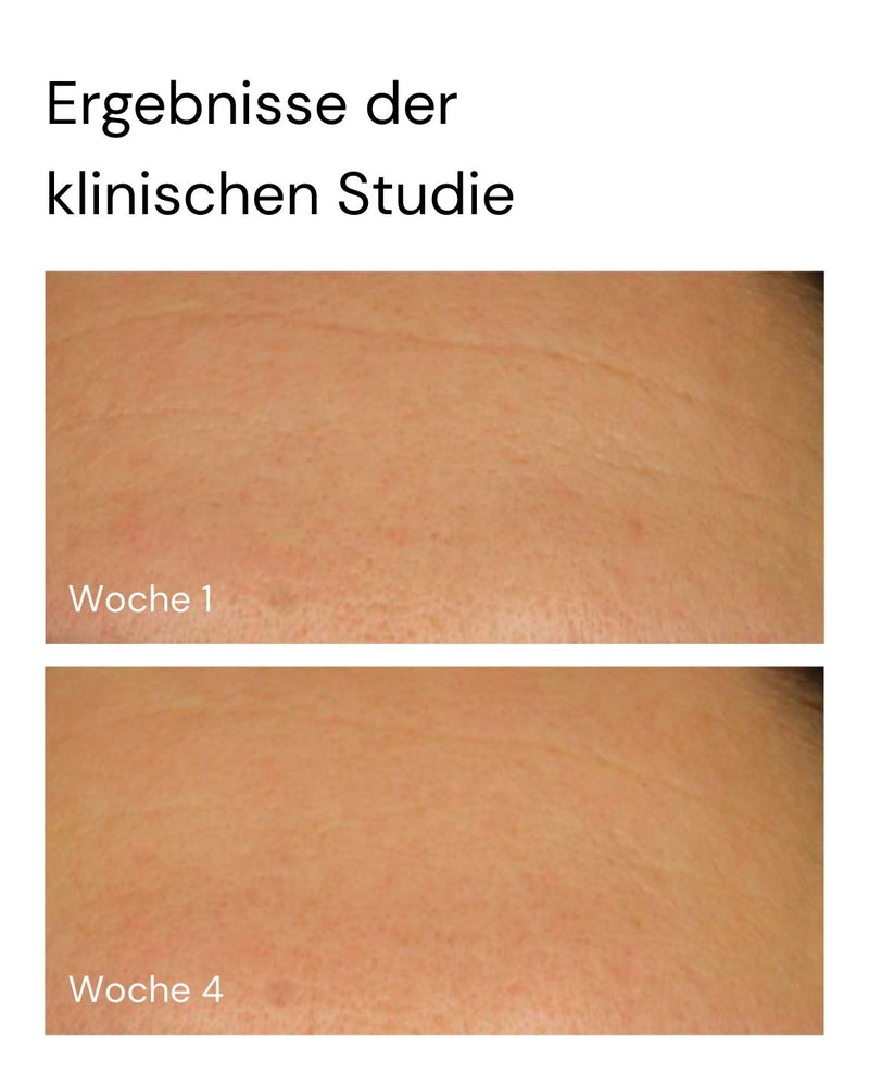 Nahaufnahmen des Hautbildes mit den Bezeichnungen "Woche 1" (oben) und "Woche 4" (unten) zeigen eine sichtbar glattere Haut und demonstrieren die klinischen Ergebnisse des Super Stable C Face Serum von MERME Berlin. Über den Bildern erscheint eine deutsche Schlagzeile.