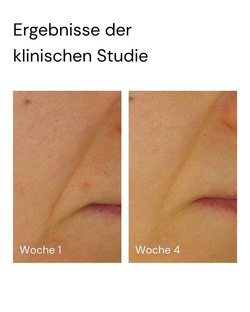 Cremige Tropfen des Super Stable C Face Serum von MERME Berlin auf einer hellen Fläche, jeder mit einem Inhaltsstoff - Scorbyl Glucosid, Sodium Ascorbyl Phosphate oder Ferulasäure - beschriftet und durch Linien mit den einzelnen Tropfen verbunden.